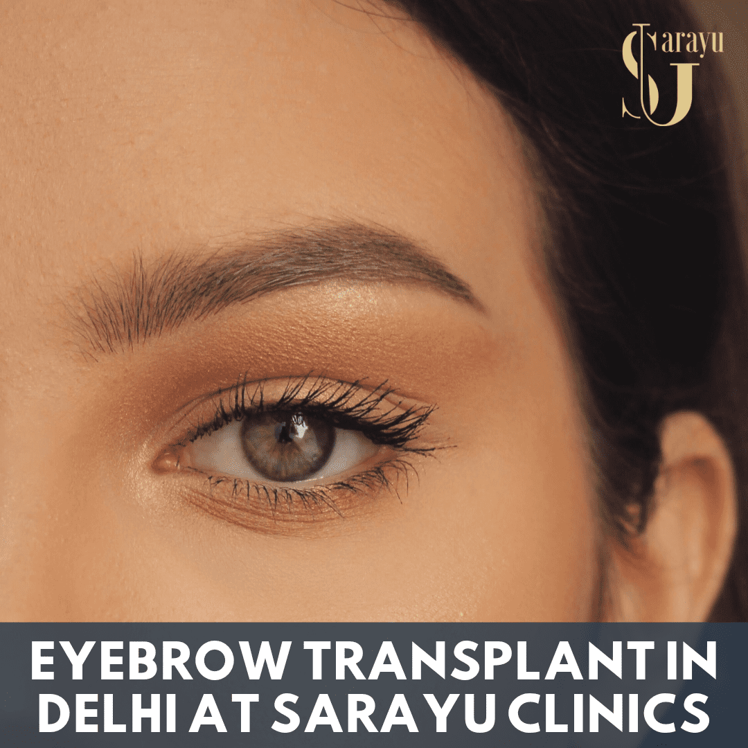 Interior of Sarayu Clinic - The Best Destination for Eyebrow Transplant in Delhi.