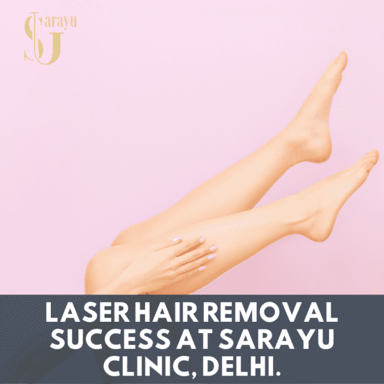 Smiling client with smooth skin after getting the Best Laser Hair Removal in Delhi at Sarayu Clinic.