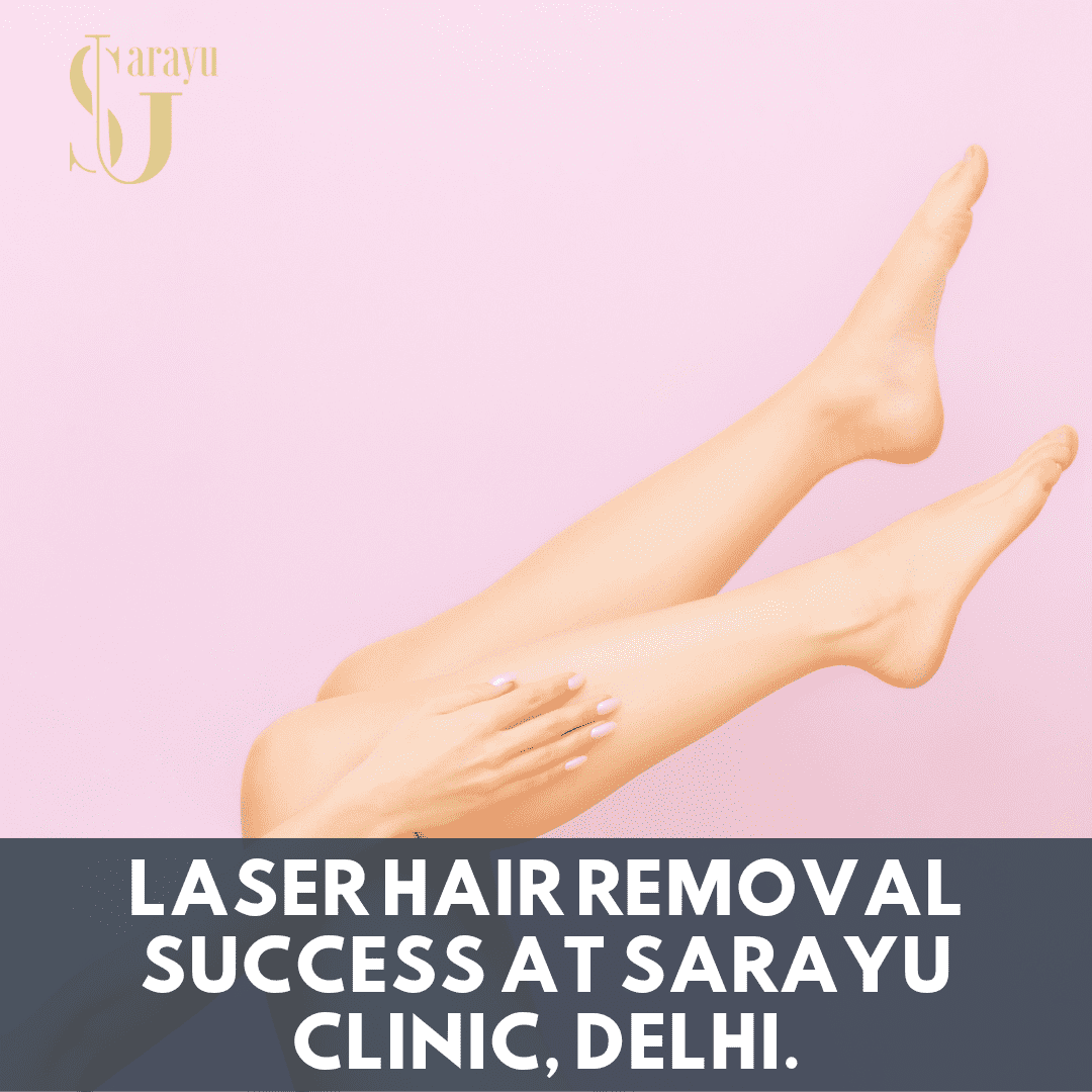 Smiling client with smooth skin after laser hair removal at Sarayu Clinic in Delhi.