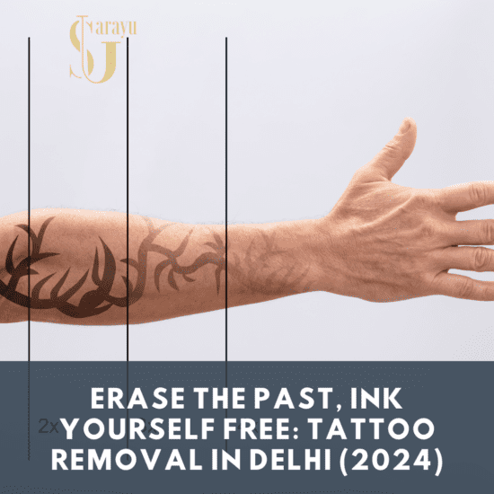 State-of-the-art laser machine used for tattoo removal in Delhi clinic, emphasizing advanced technology and expertise.