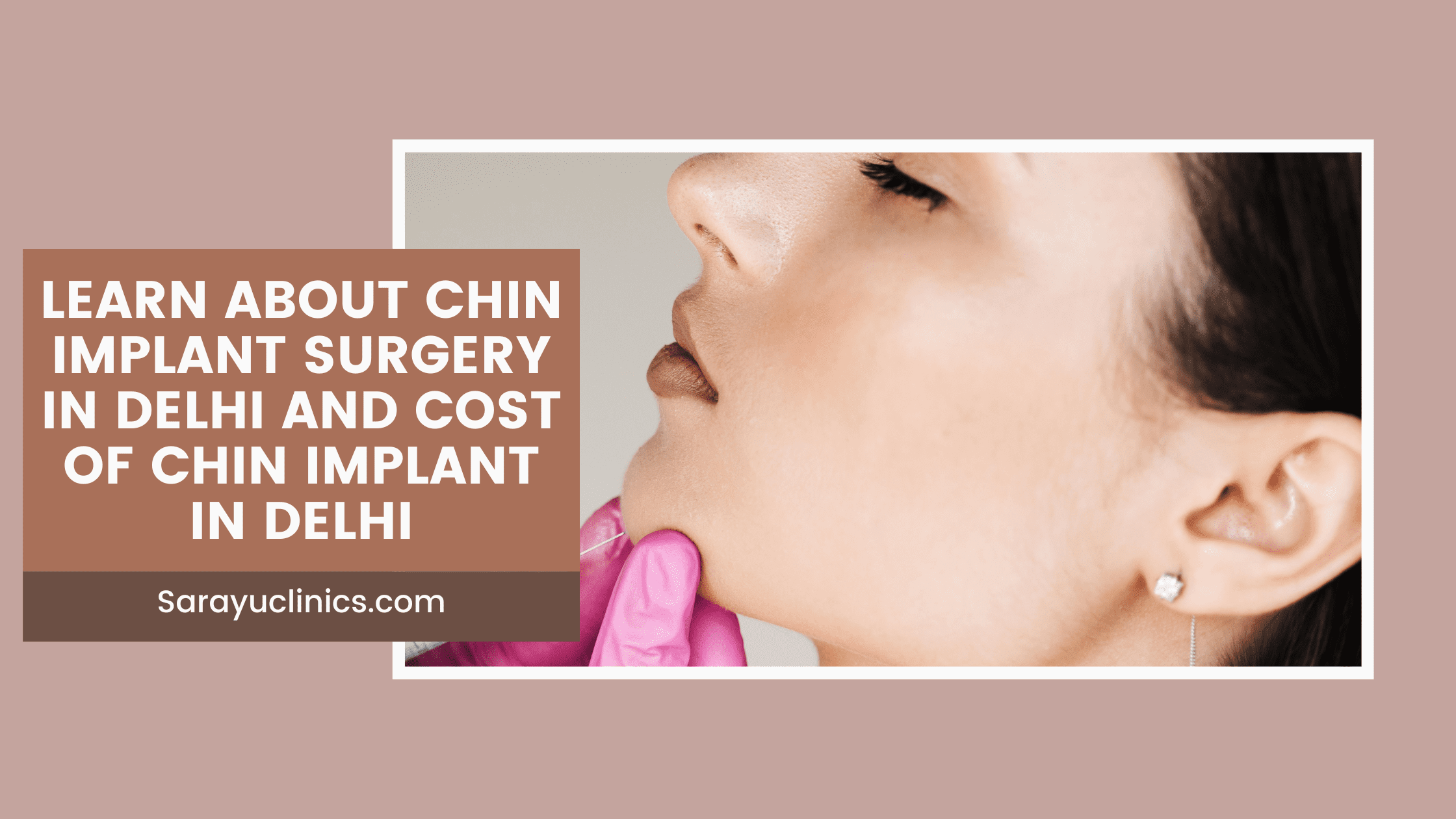 Cost of chin implant surgery in Delhi: achieve a harmonious profile and boosted confidence.
