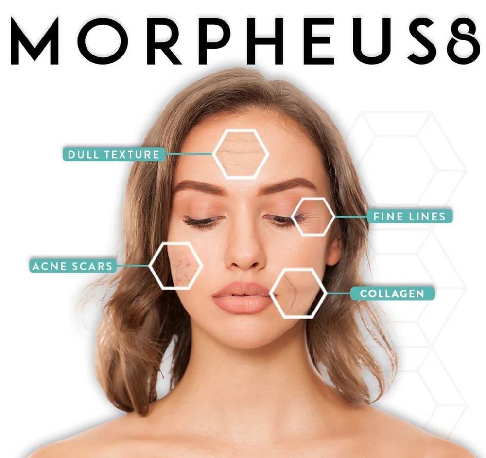 Morpheus 8 SARAYU CLINICS Morpheus 8 in Delhi