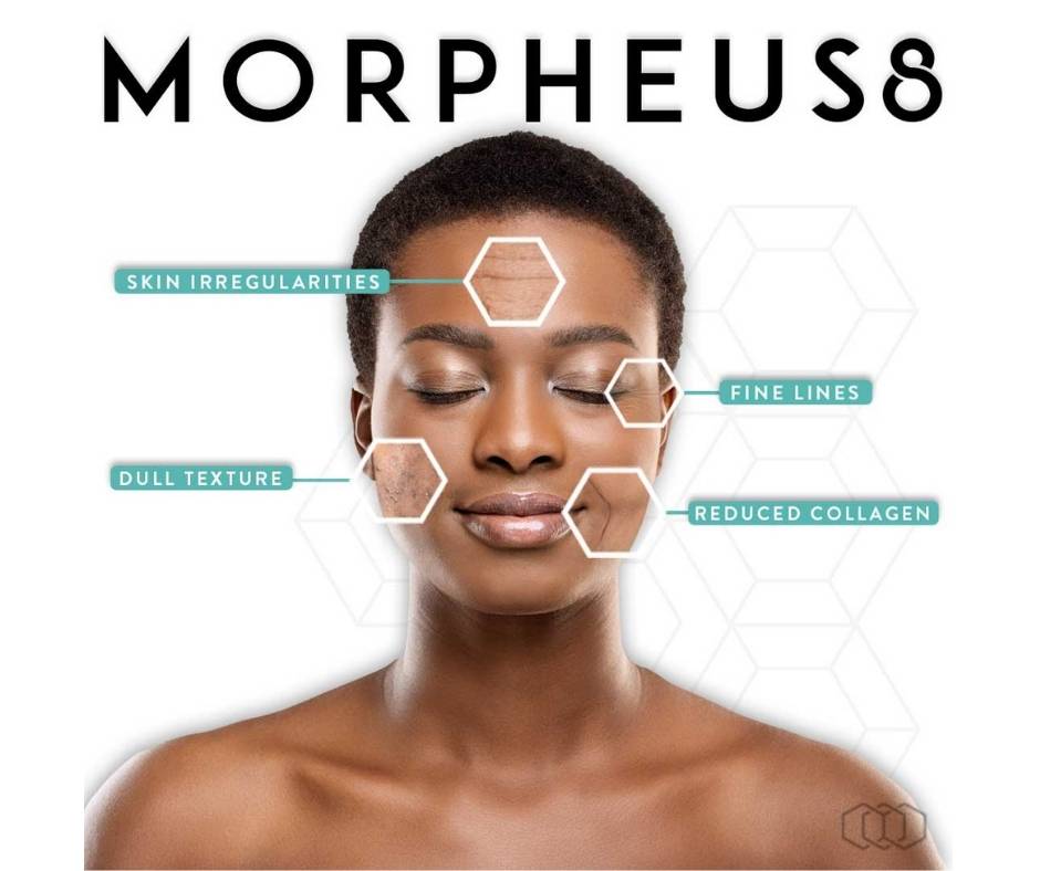 Treatments by Morpheus8 SARAYU CLINICS Morpheus 8 in Delhi