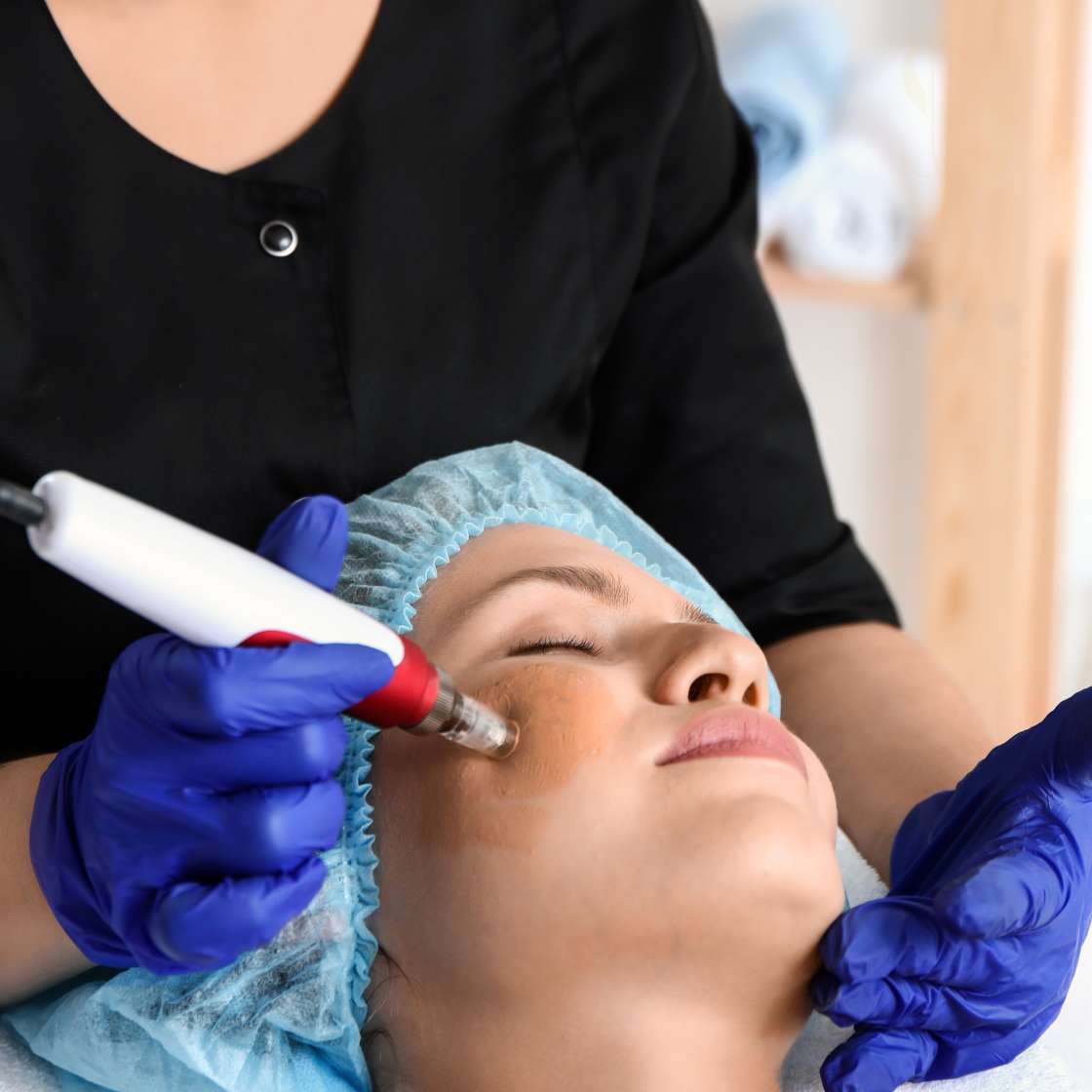 Aqua Glow Treatment in Delhi at Sarayu Clinics for glowing, refreshed skin. Aqua glow treatment in delhi price Best aqua glow treatment in delhi Aqua glow treatment in delhi reviews Aqua glow treatment in delhi price list Aqua glow treatment in delhi cost Aqua glow treatment in delhi near me