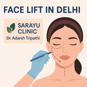 Face-lift in Delhi by Dr. Adarsh Tripathi at Sarayu Clinic