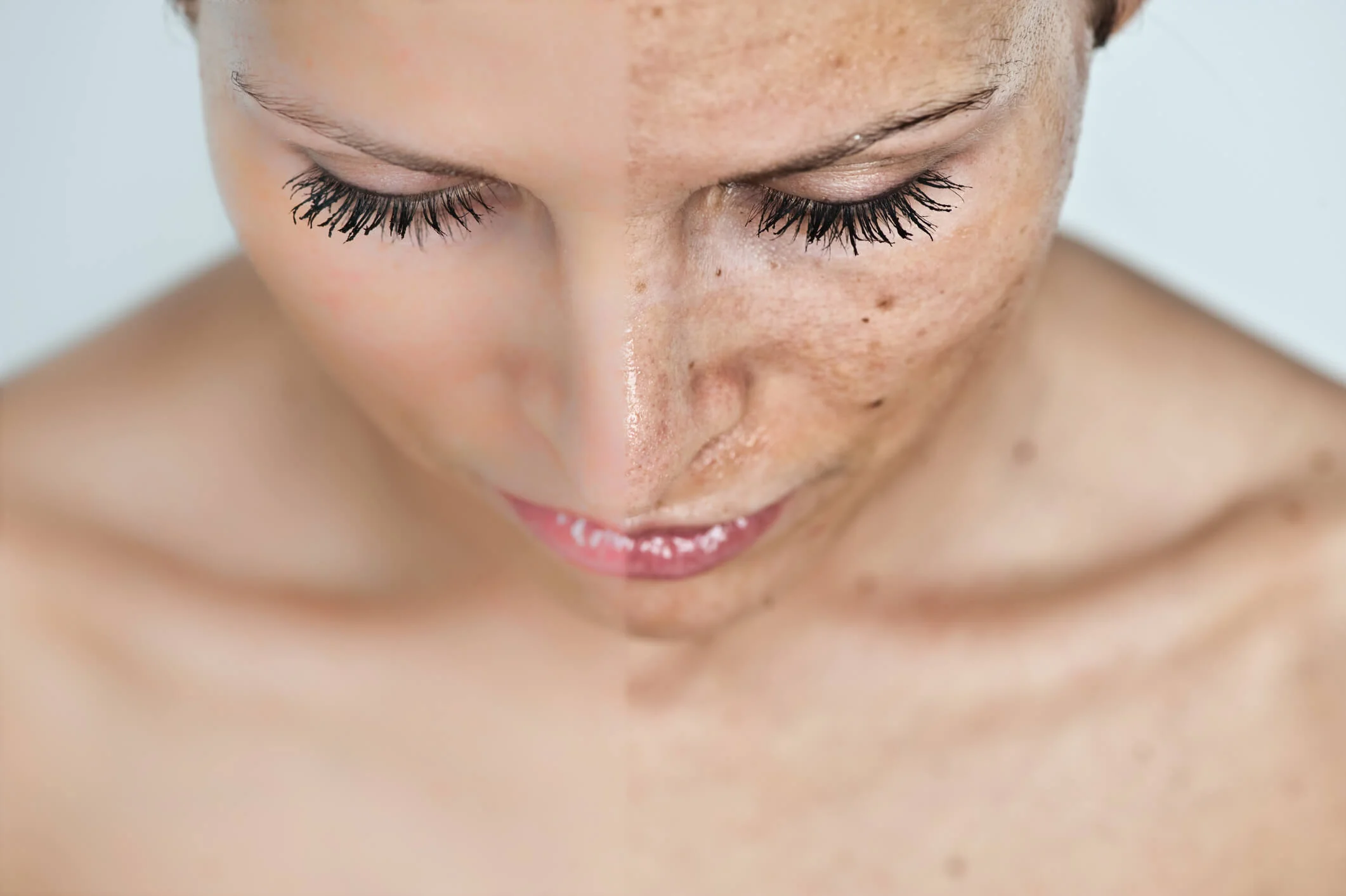 Best Depigmentation Treatment Clinic in Delhi – Sarayu Clinic