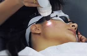 Best Depigmentation Treatment Clinic in Delhi – Sarayu Clinic