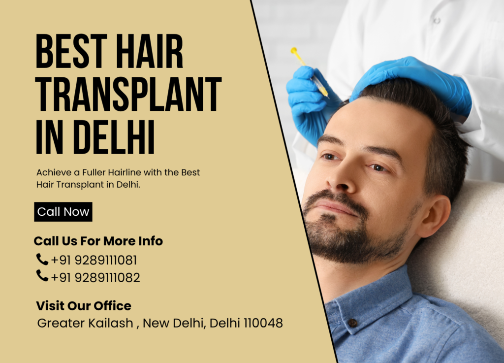 Best hair transplant in Delhi showing before and after results with natural hair regrowth