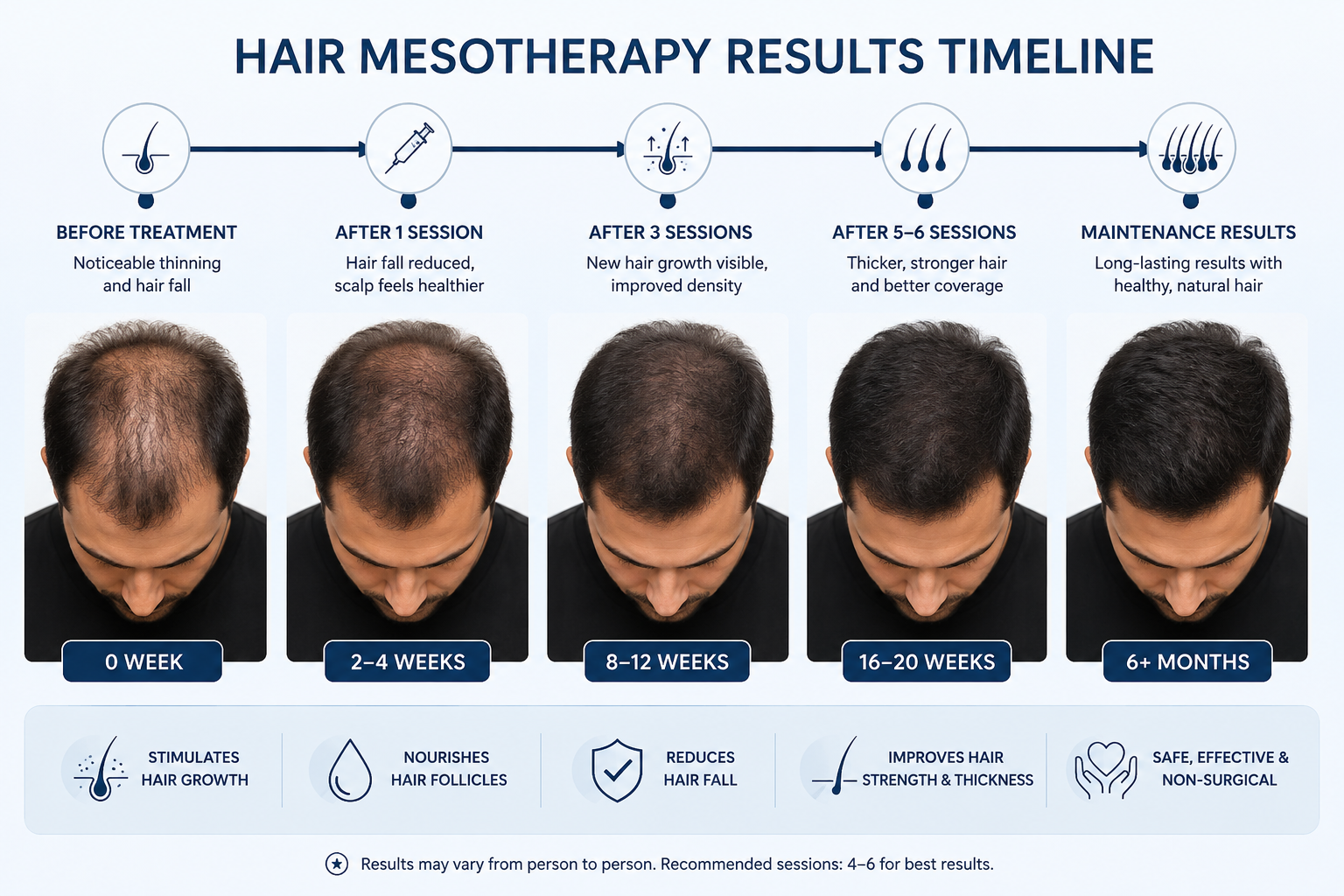 Patient receiving Mesotherapy treatment at Sarayu Clinics in Delhi for healthier hair growth and skin rejuvenation with minimally invasive therapy.