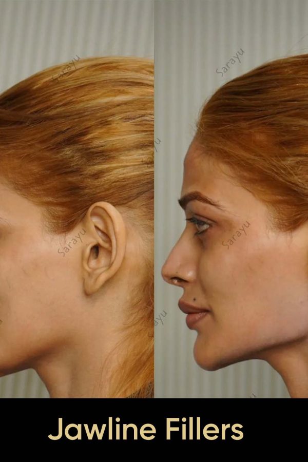 Close-up of a person with a slightly more defined jawline.