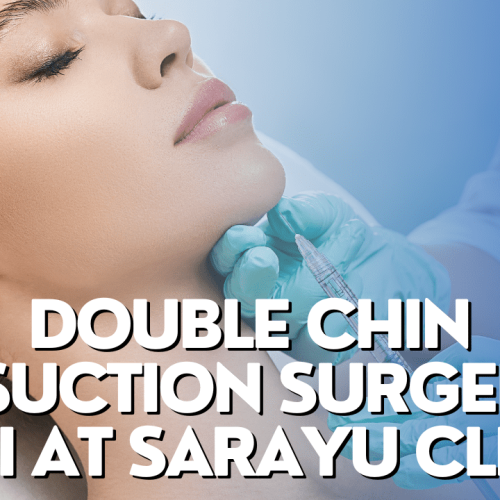 Rediscover Confidence: Transform Your Profile with Double Chin Liposuction Surgery in Delhi. Say Goodbye to Unwanted Fat and Hello to a Defined Jawline. #DoubleChinSurgery #DelhiBeauty