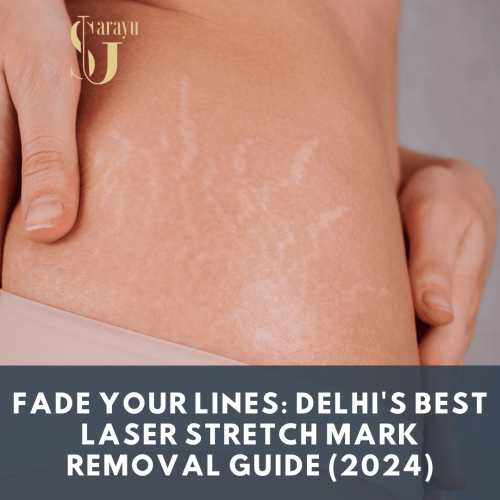 Experience the latest technology! Sarayu Clinics uses cutting-edge lasers and expert dermatologists for safe and effective Best Stretch Marks Removal in Delhi.