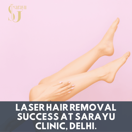 Experience the joy of smooth, hair-free skin with our advanced laser hair removal treatments at Sarayu Clinic, your trusted destination for beauty and confidence in Delhi.